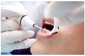 何為牙周手術?